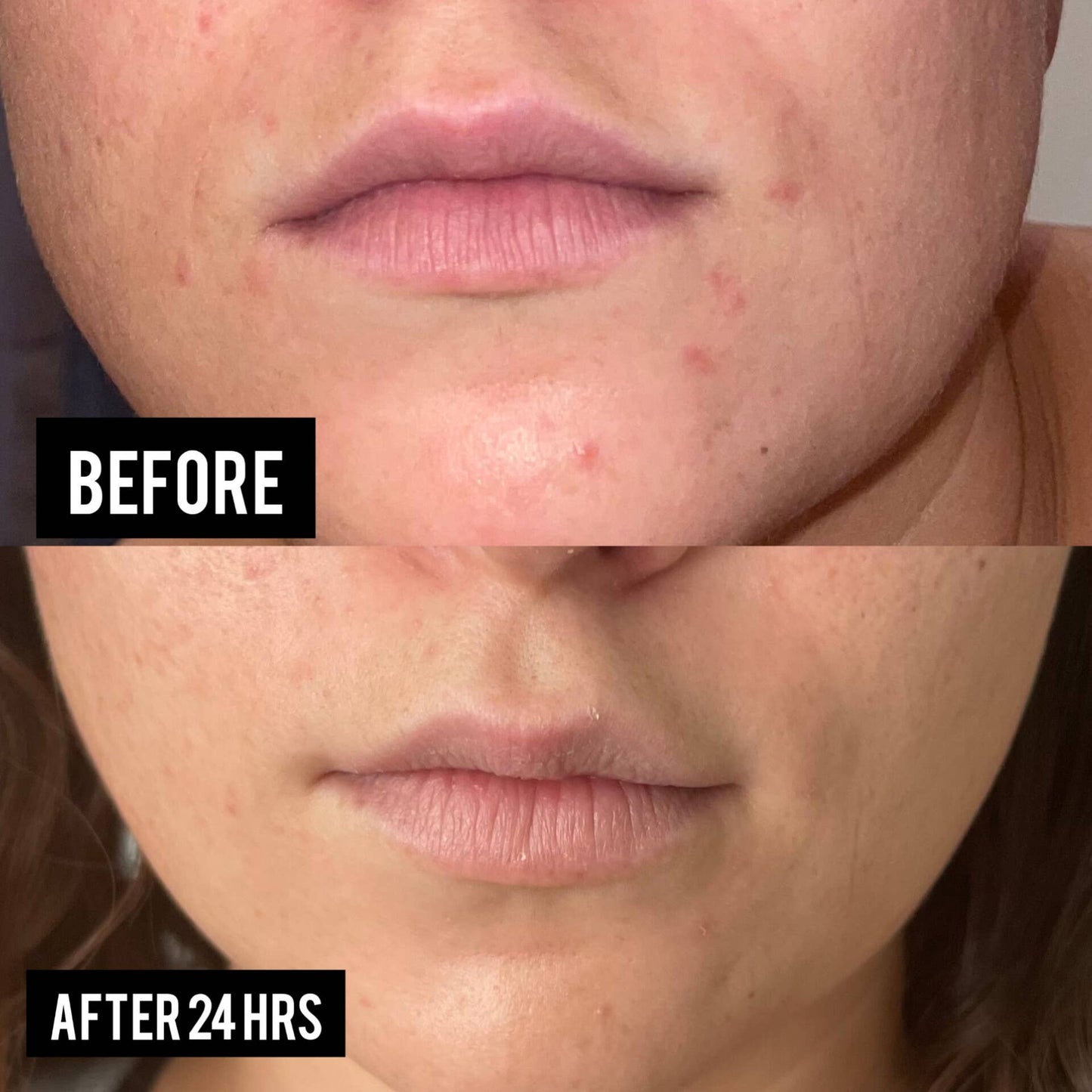 Facial Serum 150mg - USDA Certified Organic